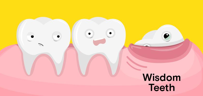 Image result for wisdom teeth