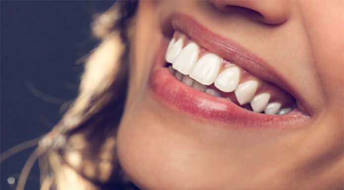 Teeth Whitening Trends