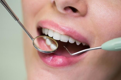Gum Disease: What You Need To Know