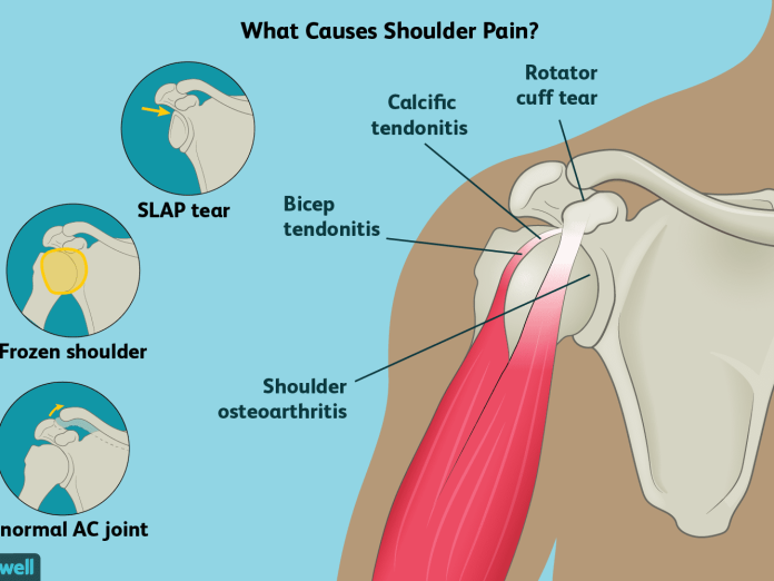Shoulder Injuries Explained