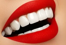Transform Your Smile with Dental Veneers