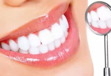 Brighten Your Smile with Professional Teeth Whitening